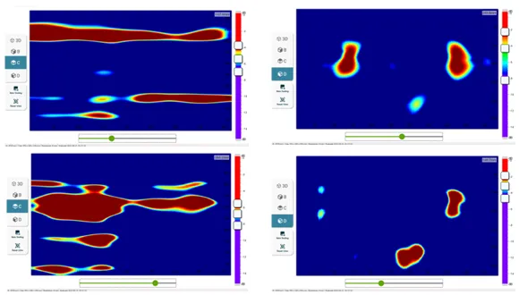 Figure 2: Selected slices from 3D volumetric data for a laboratory specimen with filled, unfilled and partially filled tendon ducts